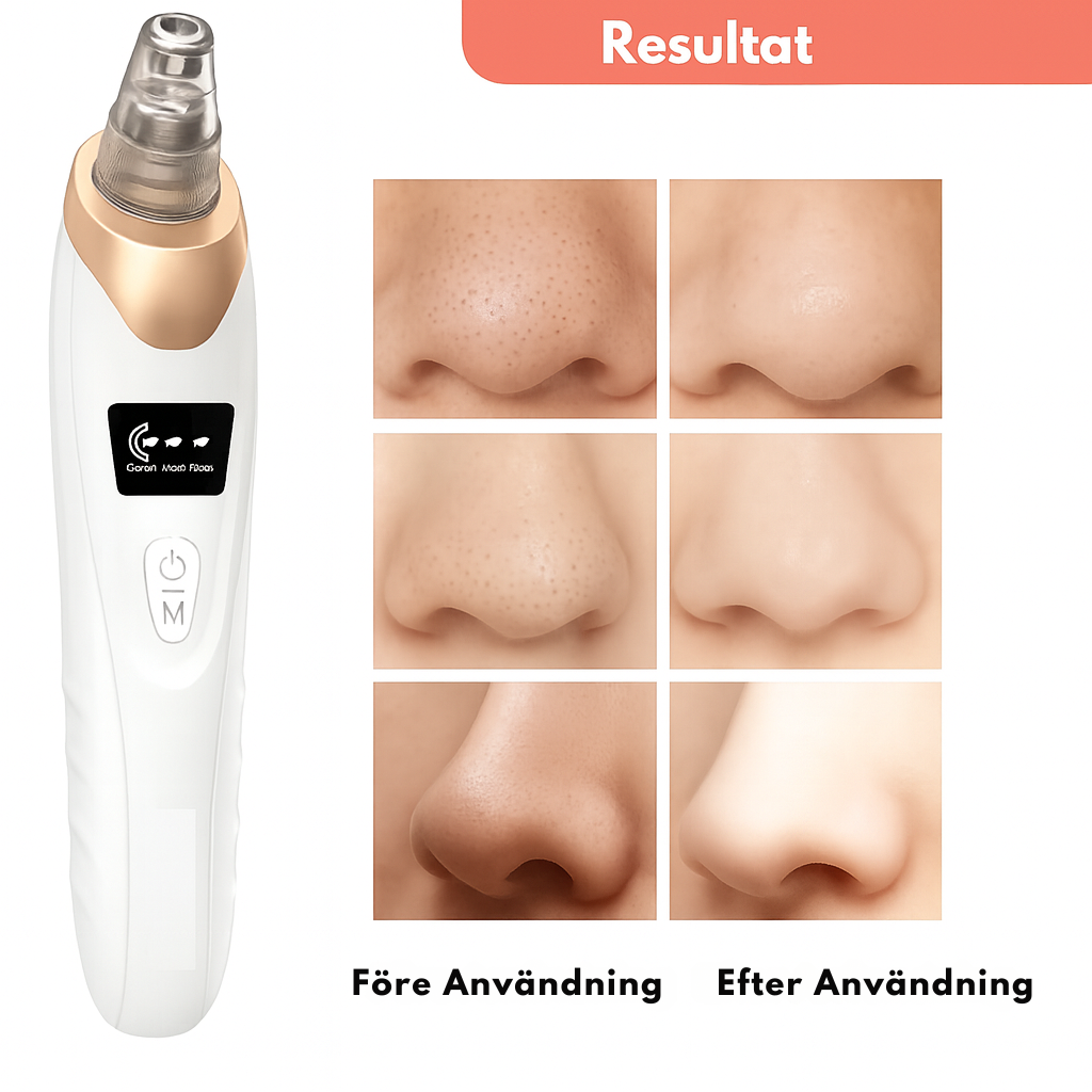 Clenor - Låt huden andas